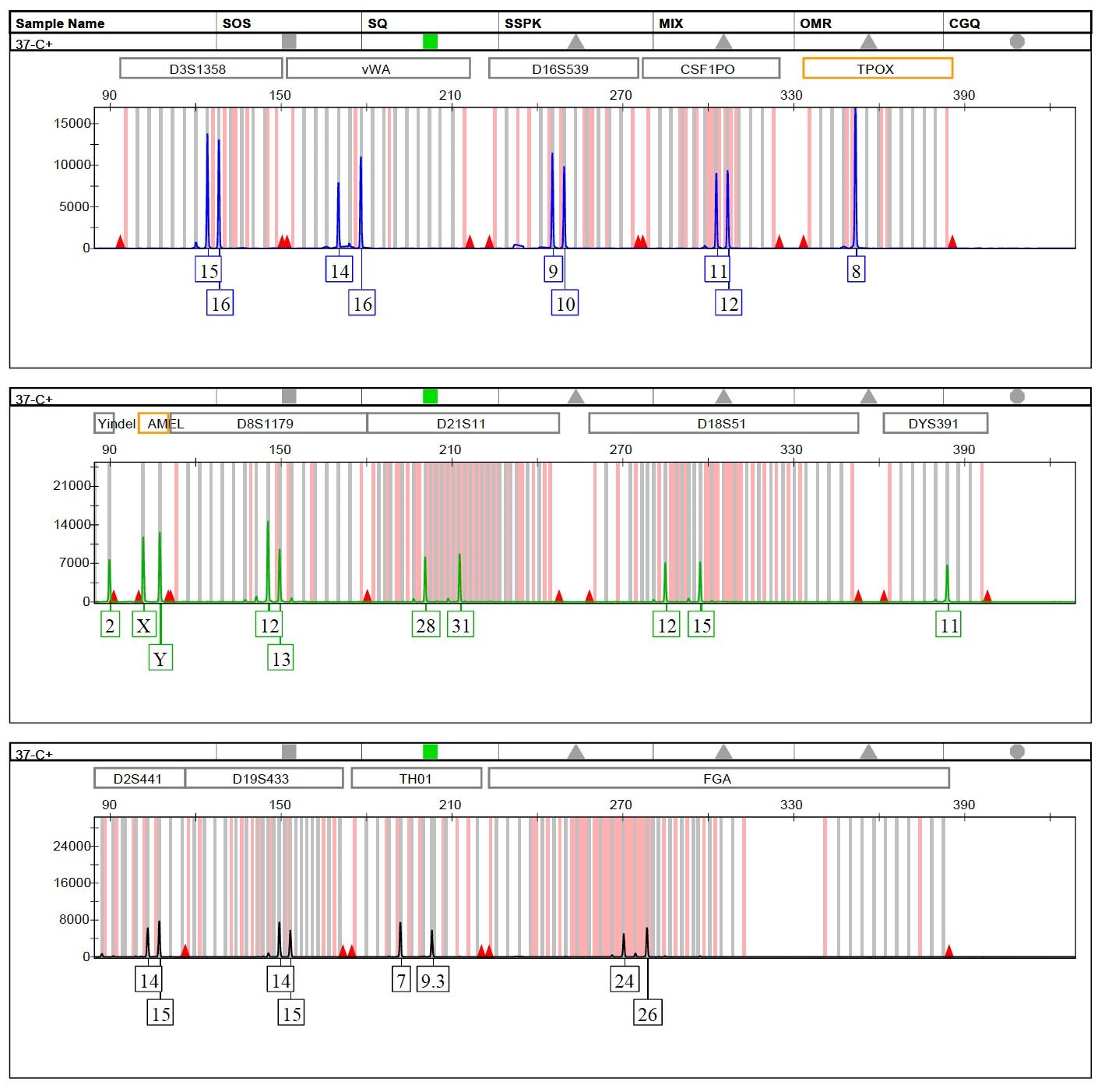 Consejo Genético Analisis Genetico En El Embarazo Estudio Genético